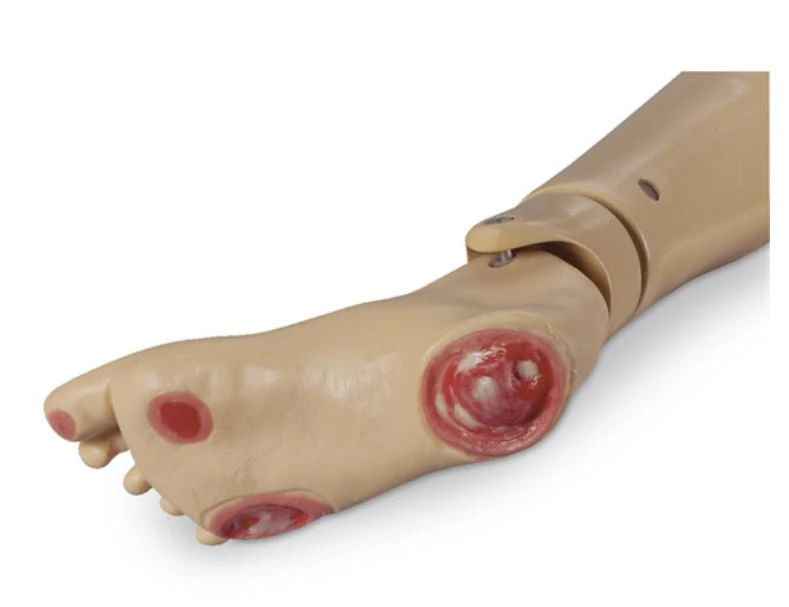 Life/form Optional Pressure Ulcer Foot for KERi/GERi Nursing Skills Manikin, Training Simulator