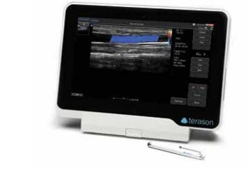 Terason 3200T Ultrasound System