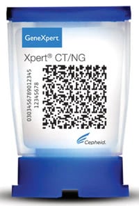 Cepheid Xpert CT/NG Assay, Chlamydia Trachomatis/Neisseria Gonorrhoeae Reagent Test, 120 Tests/Box