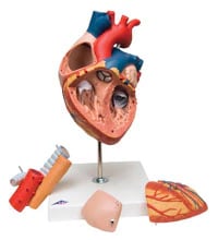 American 3B Heart with Esophagus and Trachea Anatomical Model, 5 Times Life Size, 5-Part