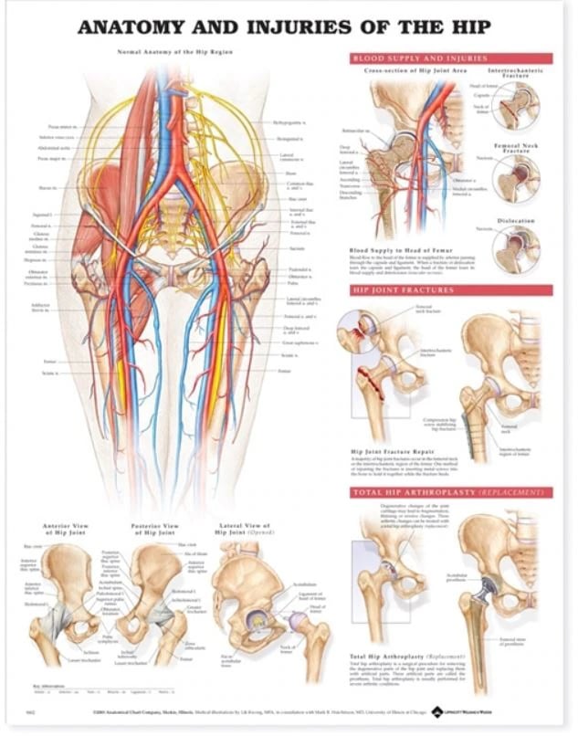 Injuries of the Hip Anatomical Chart, 20" x 26", Each
