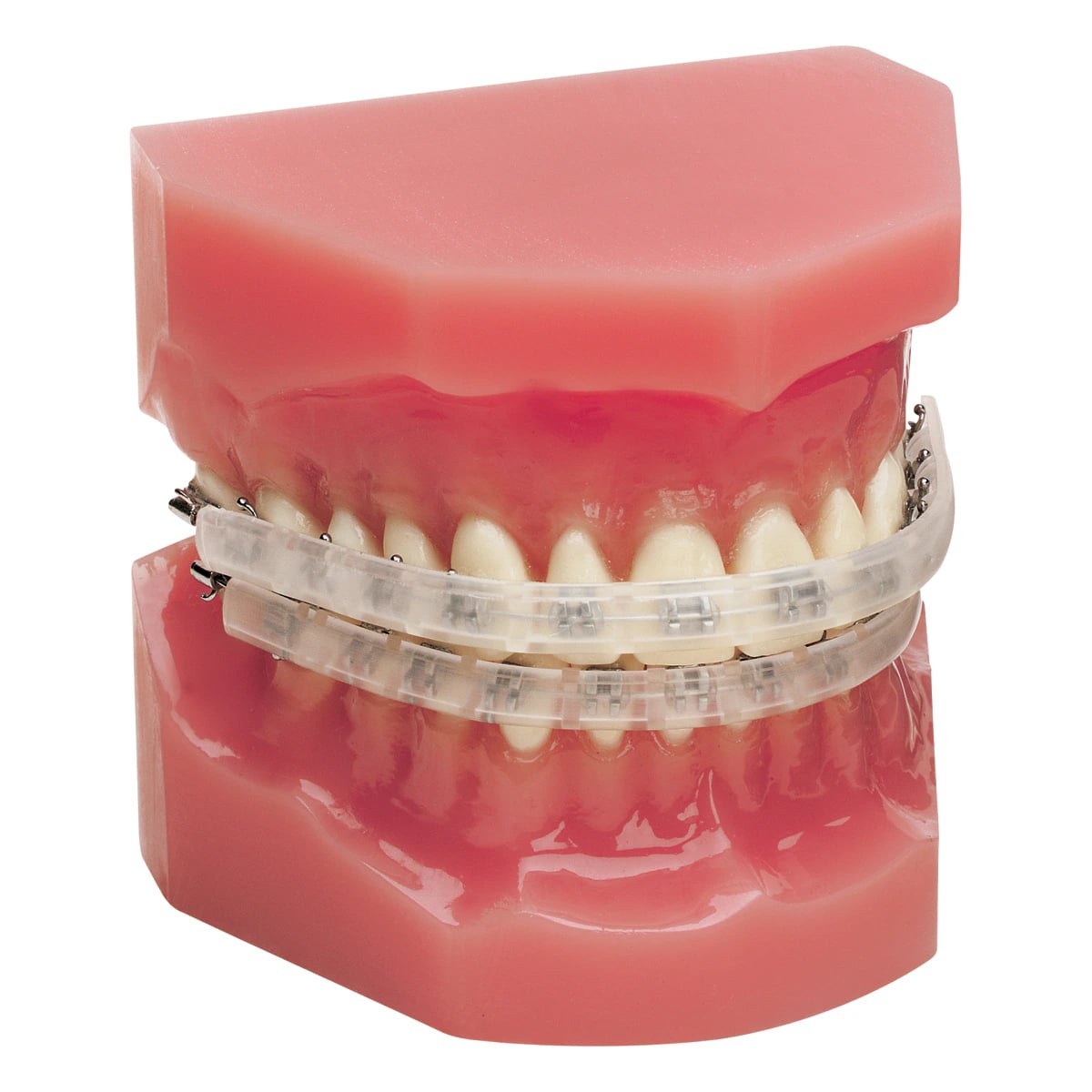 Ortho Organizers Lip Protector