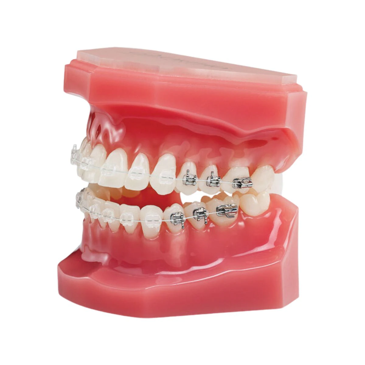 Typodont-Neolucent Plus 5X5 Orthodontic Model