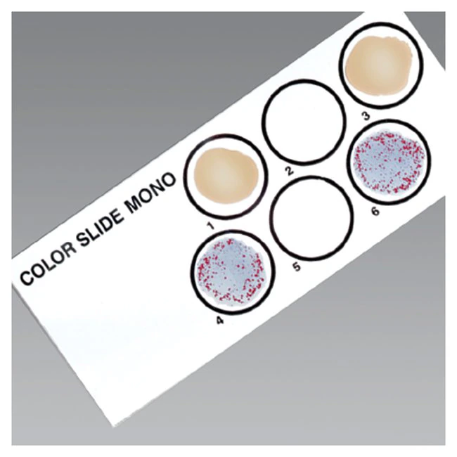 Remel Color Slide II Mononucleosis Test Kit, 50 Tests