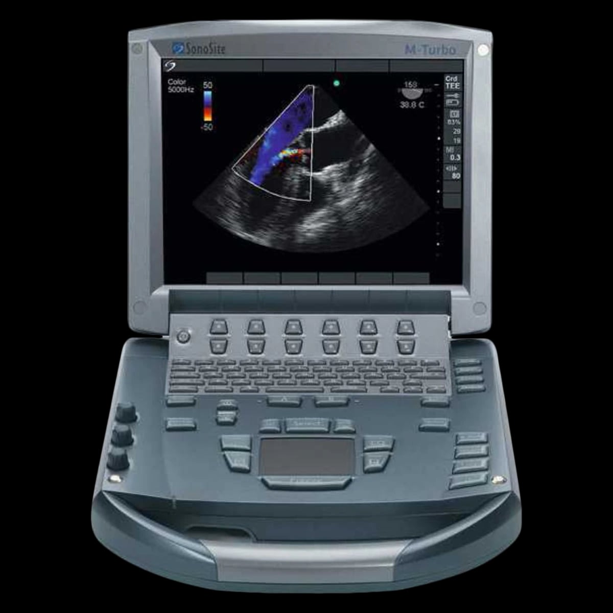 Sonosite M-Turbo Ultrasound System, Remanufactured