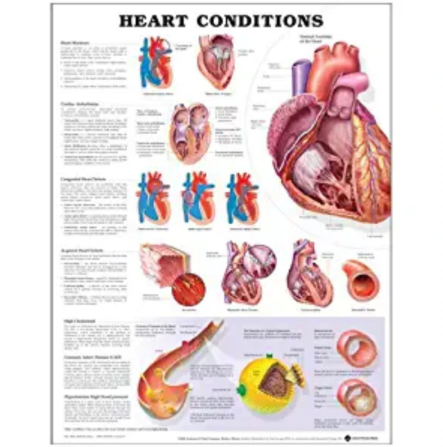 Heart Conditions Anatomical Chart, 20" x 26", with Grommets at Top Corners