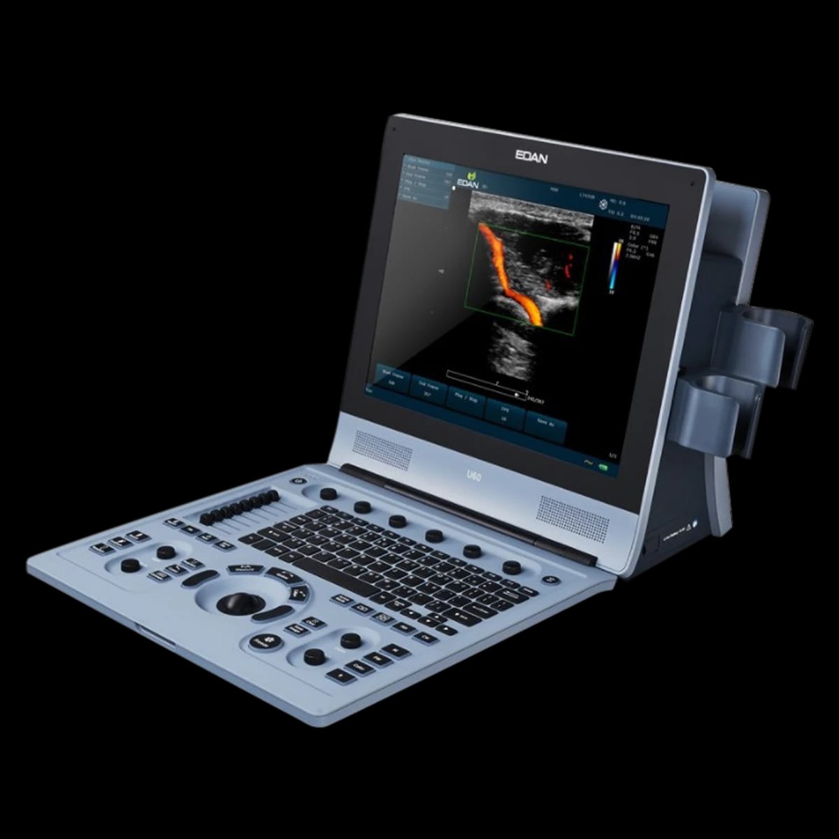 Edan U60 Doppler Ultrasound System with 2 Transducer Ports and DICOM