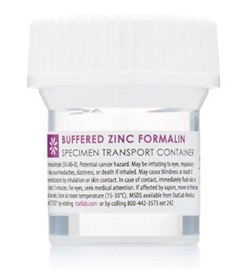 Statlab Medical Products Prefilled Container, Buffered Zinc Formalin, 60 mL, 96/Case