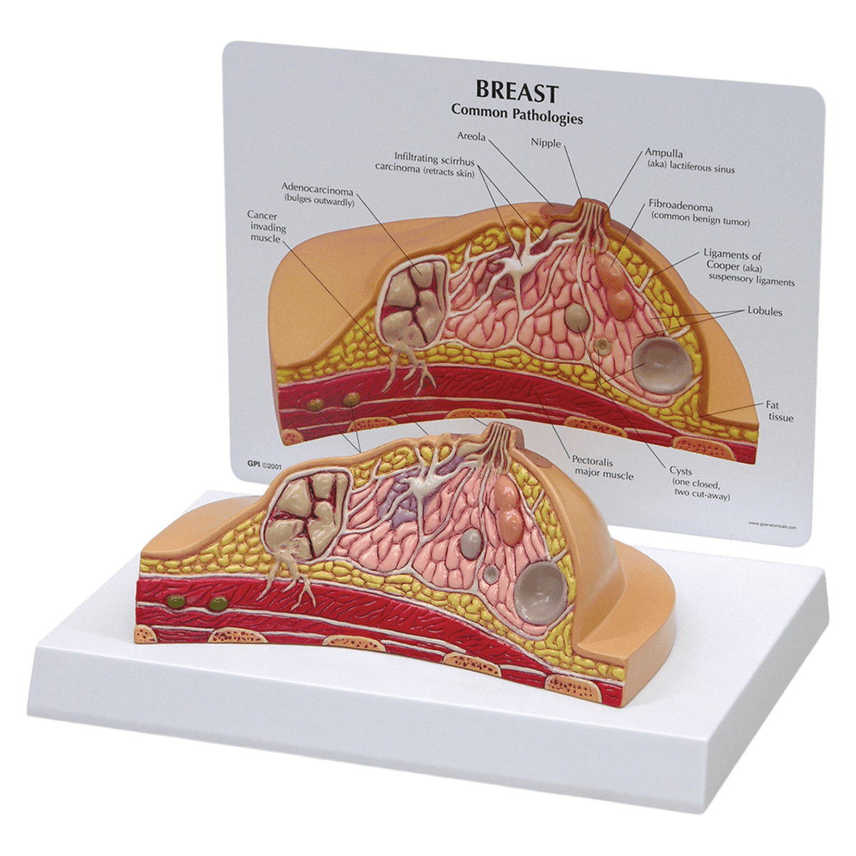 Nasco Healthcare Model Breast Cross Section Training Model, 6-1/2" x 4-1/2" x 3", White with Card, 01KWC87QE2SVSA4EWEKHGHFQDN