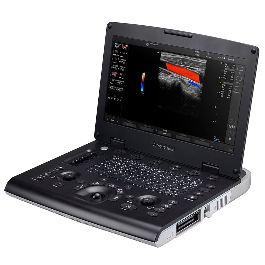 GE Versana Active Ultrasound System