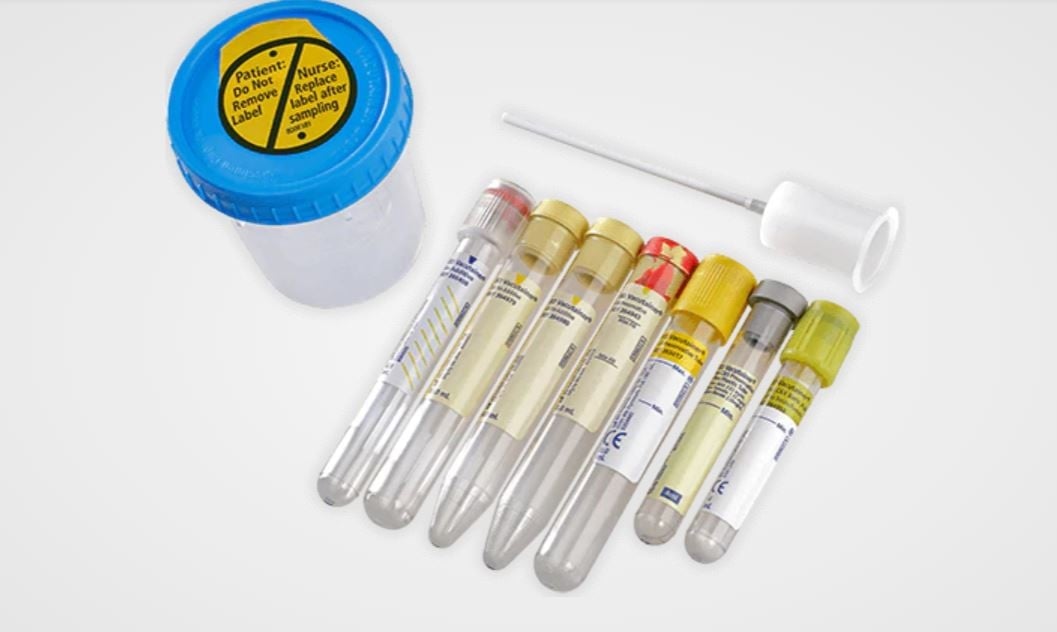 BD Vacutainer Urine Specimen Collection Tube, 4mL, Preservative, Sterile, Green Hemogard Closure, 13mm x 75mm, Round Bottom, 1000/Case