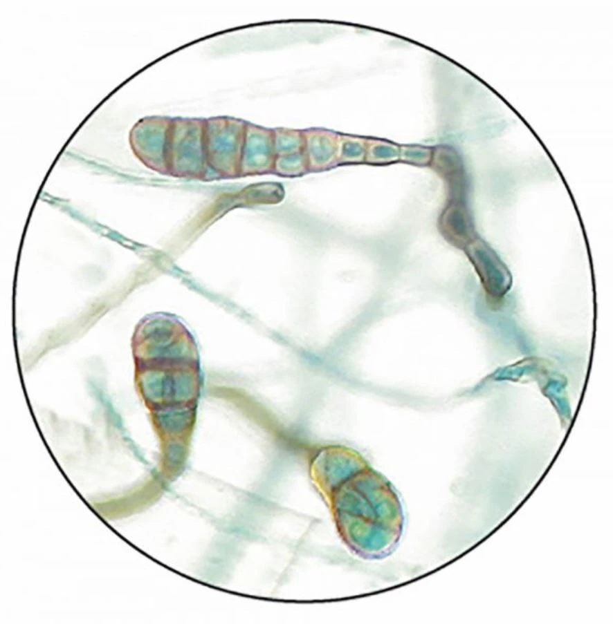 Prepared Microscope Slide, Aspergillus fumigatus, 3" x 1" (Scientific Device Lab)