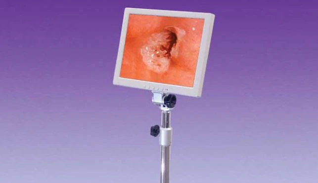 Gynex Corporation Monitor Only for Desktop/Galileo VC Colposcope (No Stand)