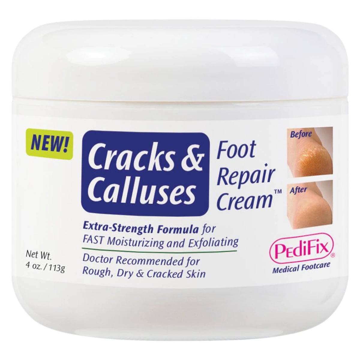 Pedifix Cracks & Calluses Repair Cream, Foot, Opaque White, 4 oz Tube