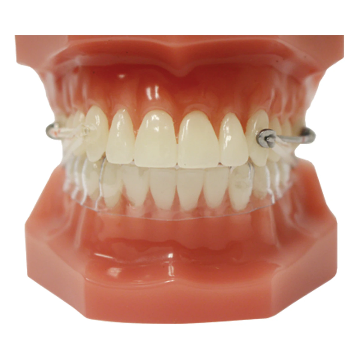 Carriere Motion 3D Class II Typodont 50/50