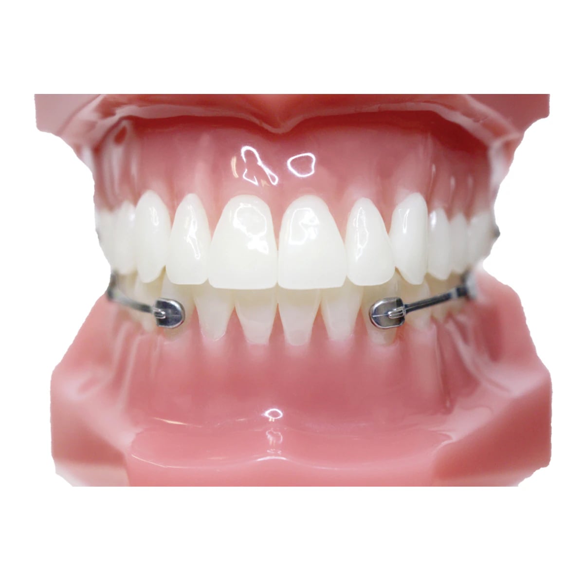 Carriere Motion 3D Class III Typodont