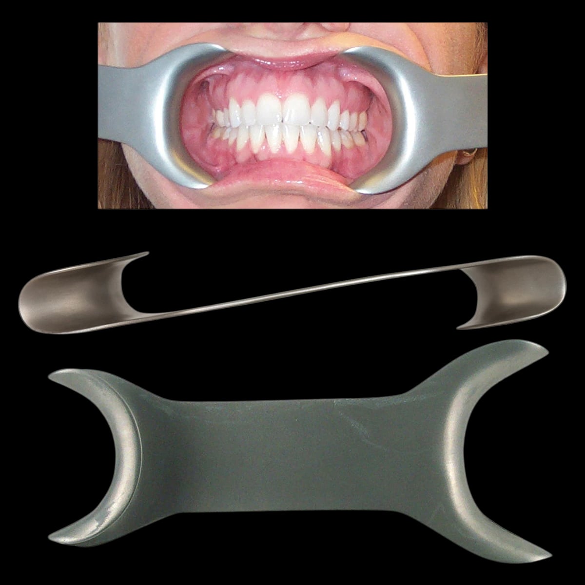 Ortho Technology SS Photo Retractor Double-Ended, Stainless Steel, 2/Pack