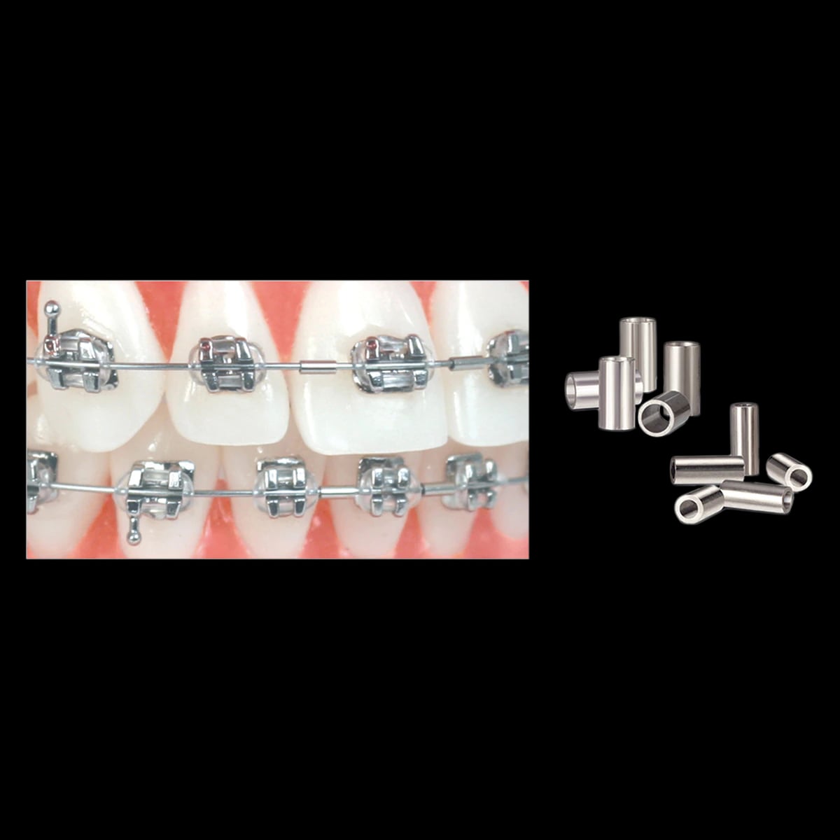 Ortho Technology Crimpable Mini Stops, Small, Stainless Steel, 25/Pkg, 020-200