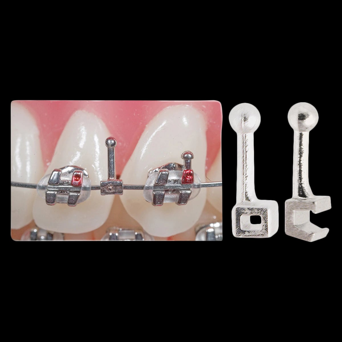 Ortho Technology SPLT Ball HK SM .018x.025, Split Ball Hook & Stop, 3.2 mm, 10/Package