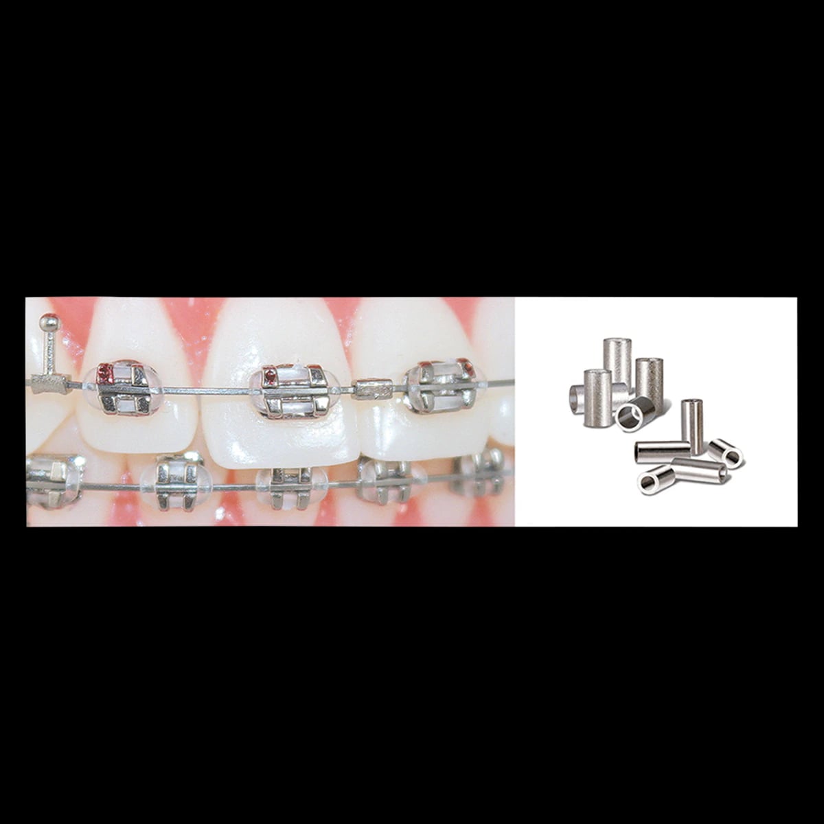 Ortho Technology Crimpable Mini Stops, Stainless Steel, Large, 50/Package