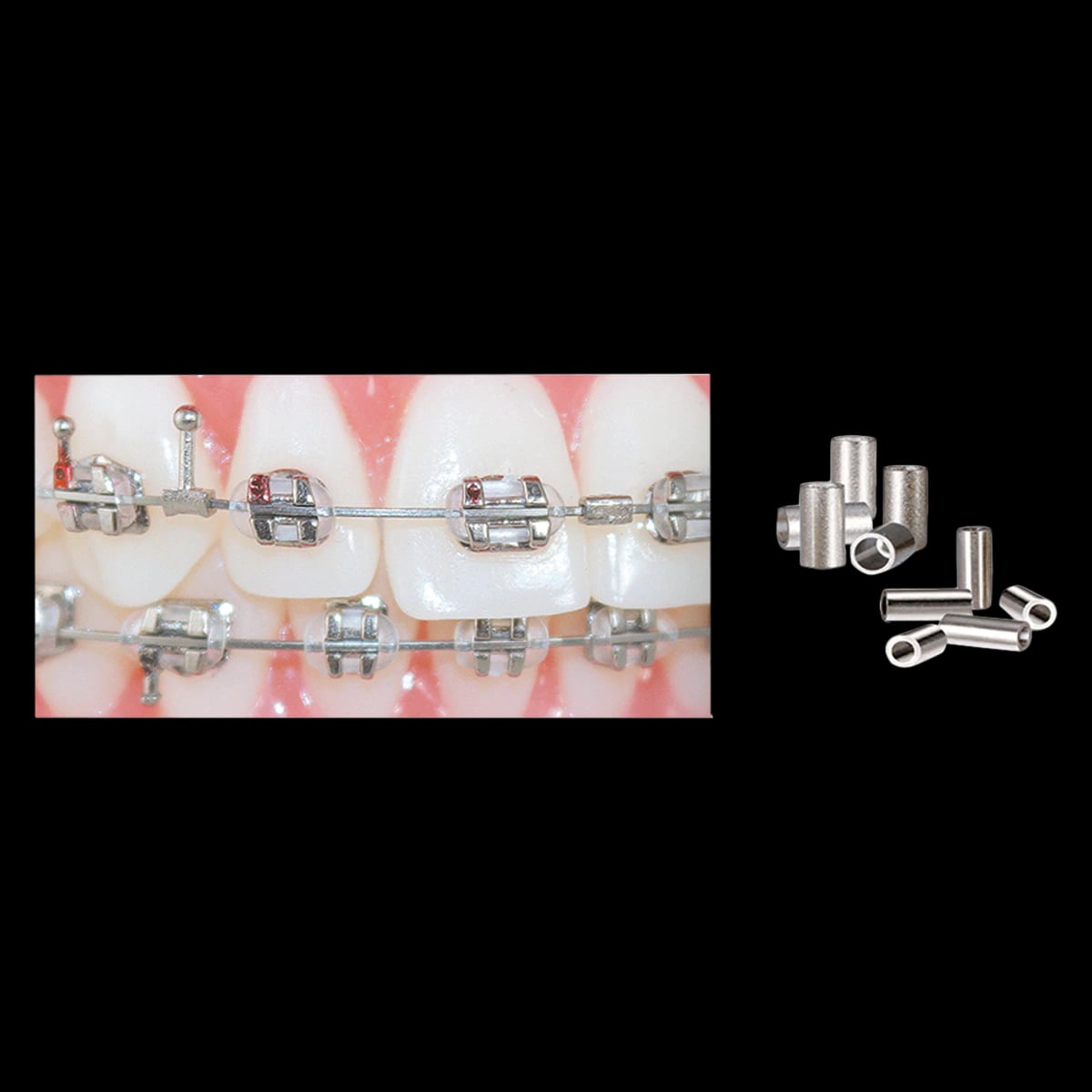 Ortho Technology Crimpable Mini Stops, Stainless Steel, 50/Pk
