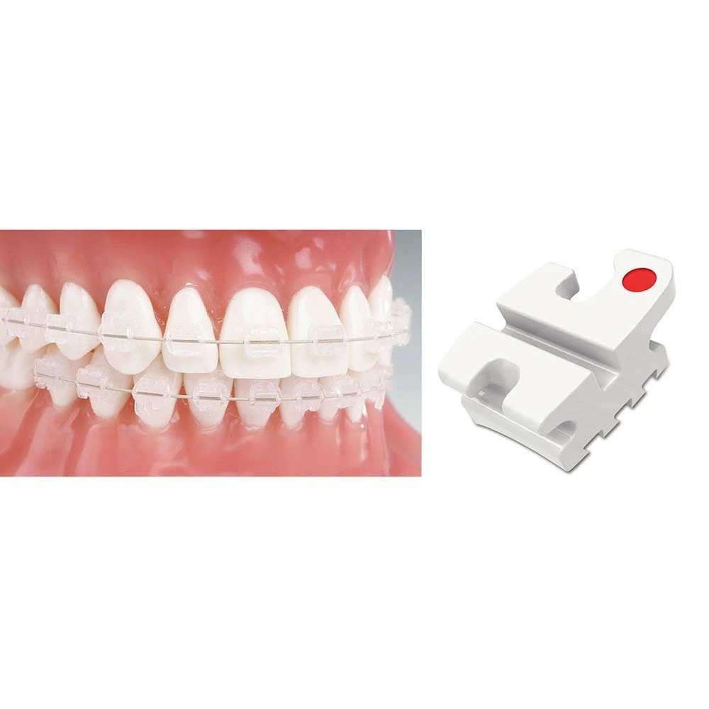 Reflections U4/5 Roth Ceramic Bracket, .022 Slot, With Hook, 10/Pk