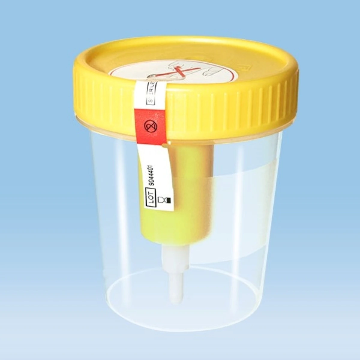 Sarstedt Urine Transfer Container, 100 mL, Polypropylene, Sterile, Graduated, Yellow Screw Cap, 200/Case