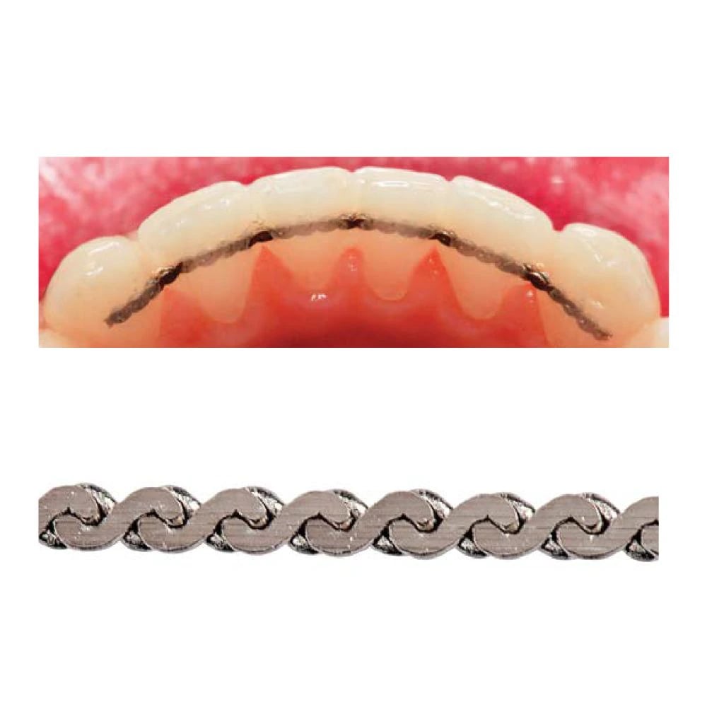 Ortho FlexTech Retention System, 14 Karat White Gold, 30-Inch Spool