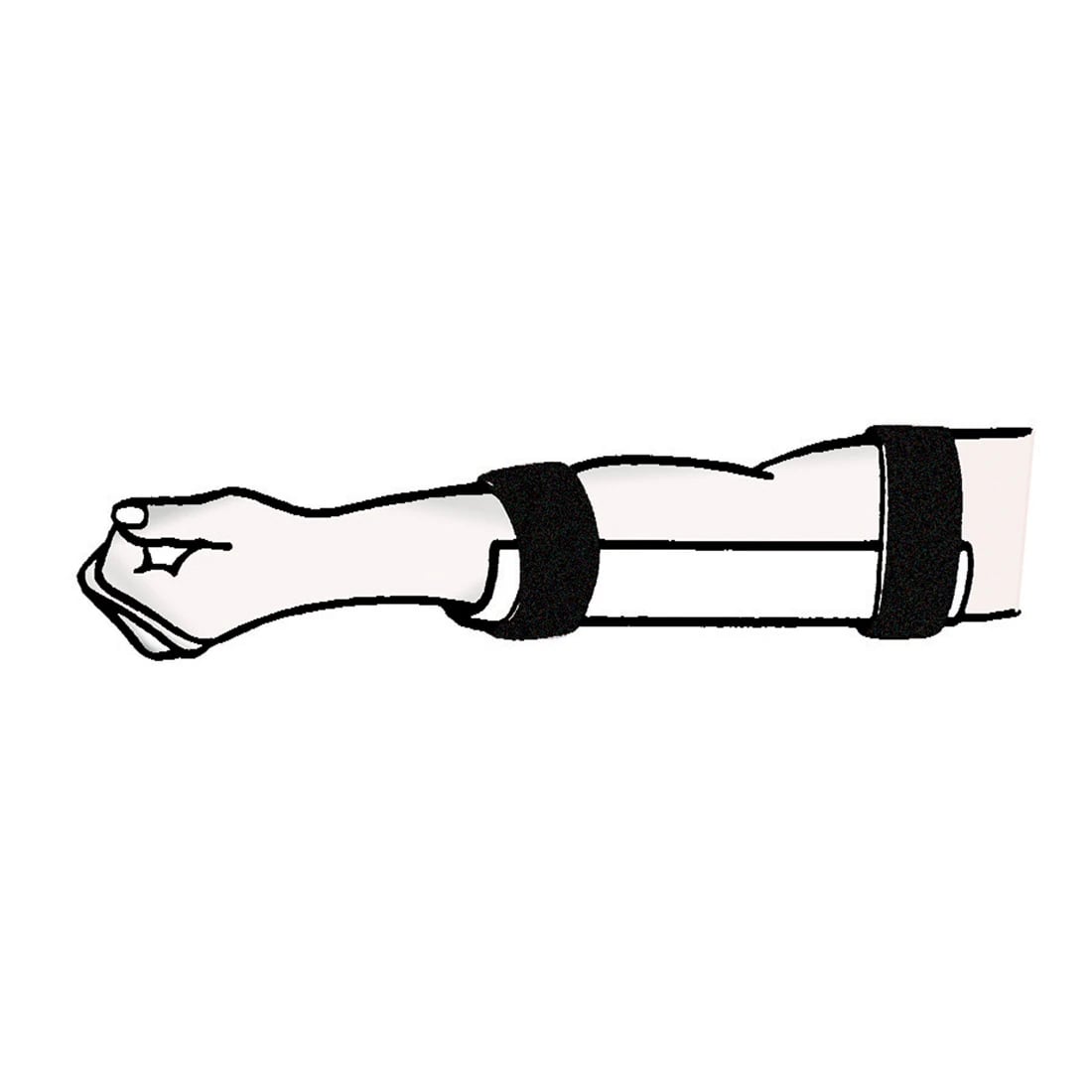 Ace Surgical Elbow Immobilizer Adult, IV Armboard, 9x3.5", Latex-Free, Reusable Velcro Straps, 01KT8PD5BP0RRWGNYWEH26T5AW