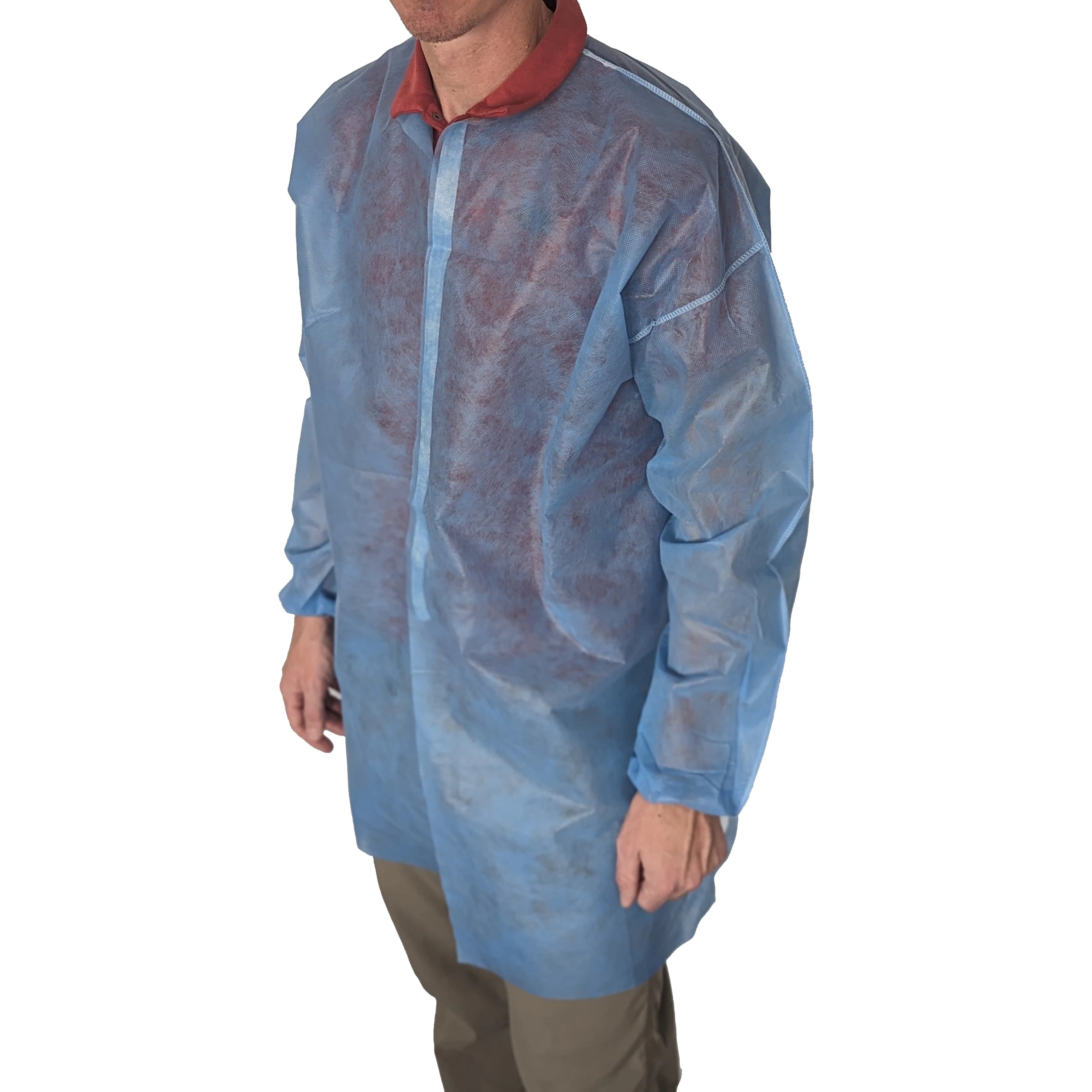 Prosafe Disposable Long-Sleeve Jacket, X-Small, Blue, Fluid Resistant, 5/Bag