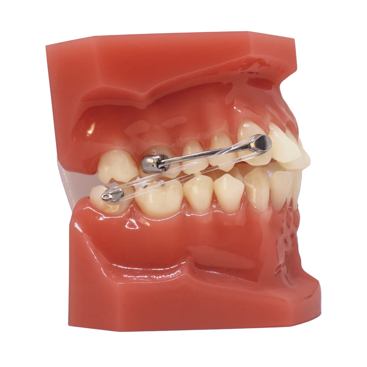 Carriere Motion Pro Class II Typodont