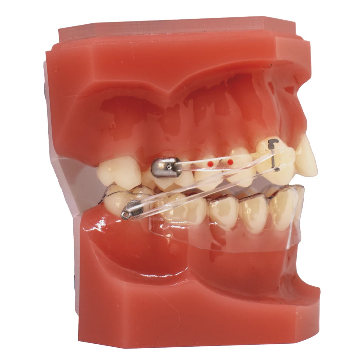 Carriere Motion Pro Clear Class Typodont