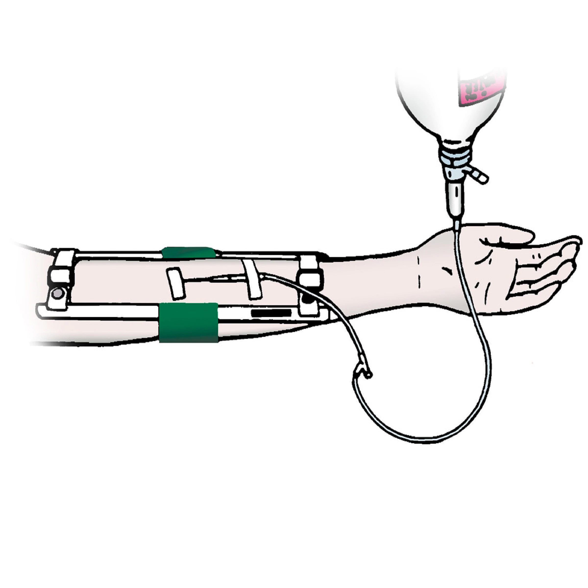 Elbow Immobilizer Adult, Each