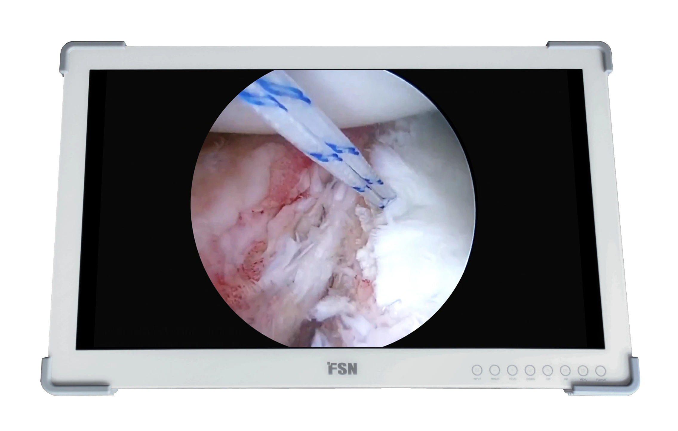 Foreseeson 27" FHD Medical Display Monitor