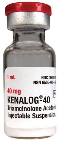 Kenalog-40 Injection, 40mg/mL, Single Dose Vial (SDV), 1mL Each