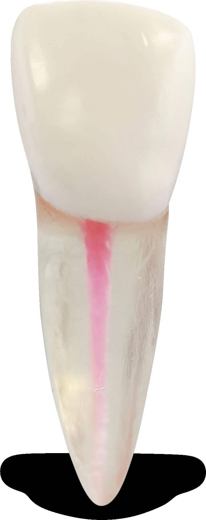 Real-T Endo Tooth #08 RL - Central Incisor, Maxillary Right, Radiolucent Practice Tooth