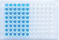 Gold Standard Diagnostics HSV 1 & 2 IgM ELISA Test Kit, 96 Tests