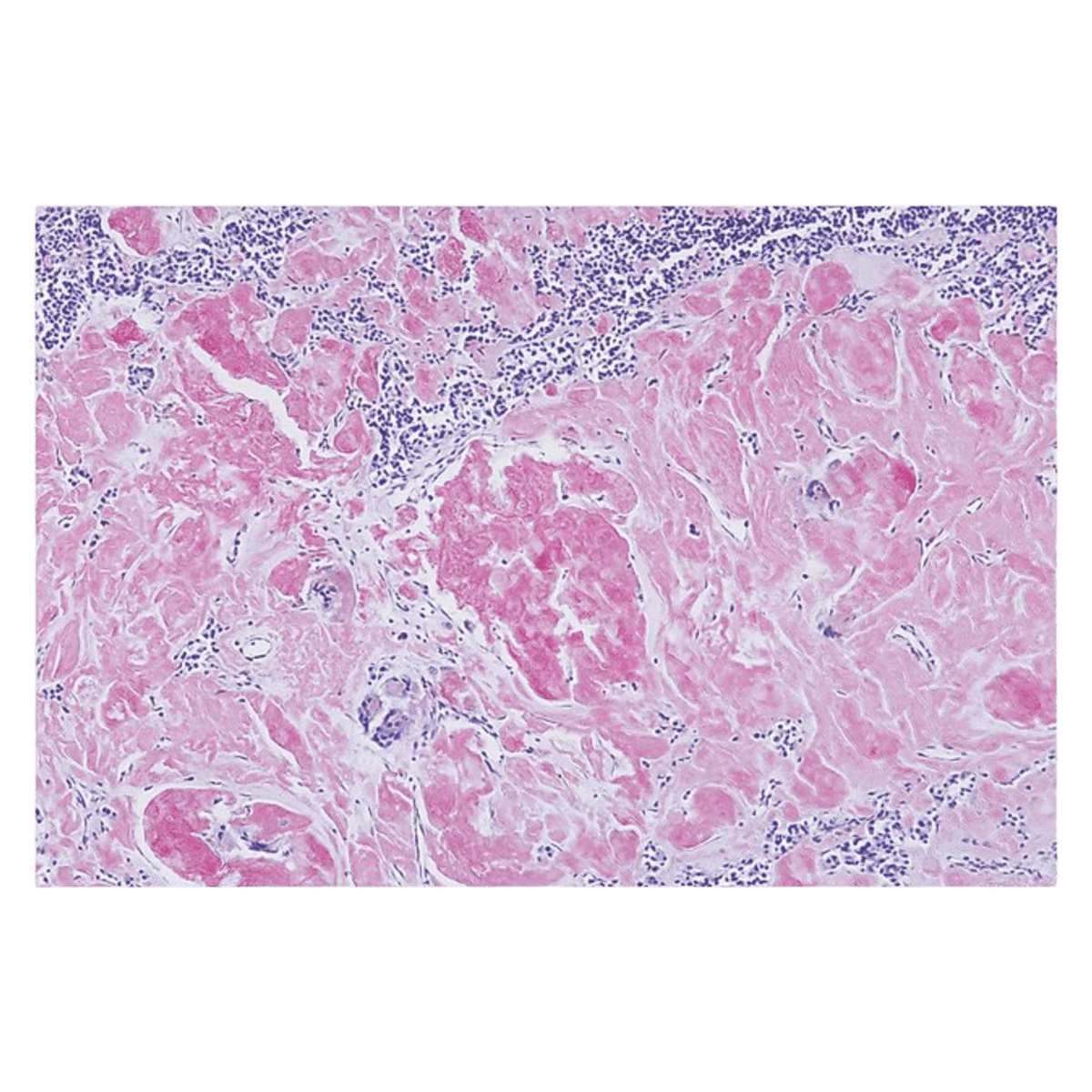 Richard-Allan Scientific Amyloid Stain Kit