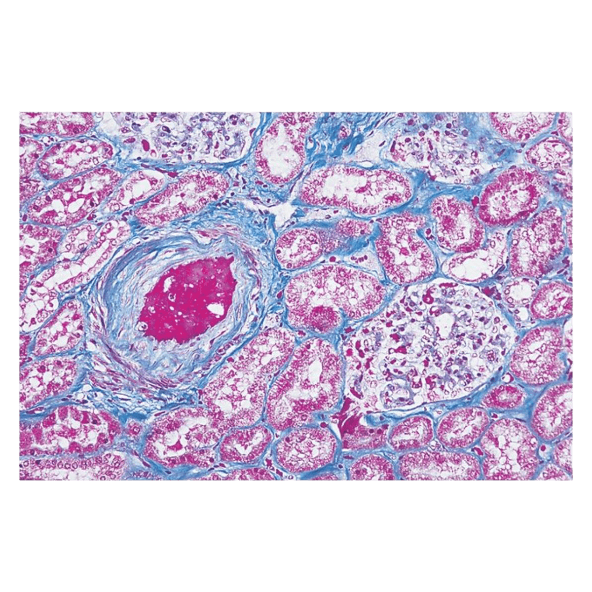 Stain Kit Masson Trichrome, Richard-Allan Scientific