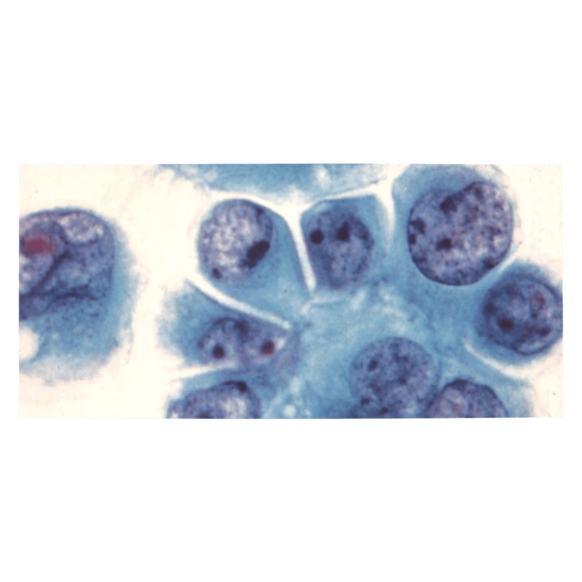Richard-Allan Scientific Reticulocyte Stain, 125 mL Bottle