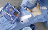 Cardinal Health Arthroscopy Shoulder Procedure Pack