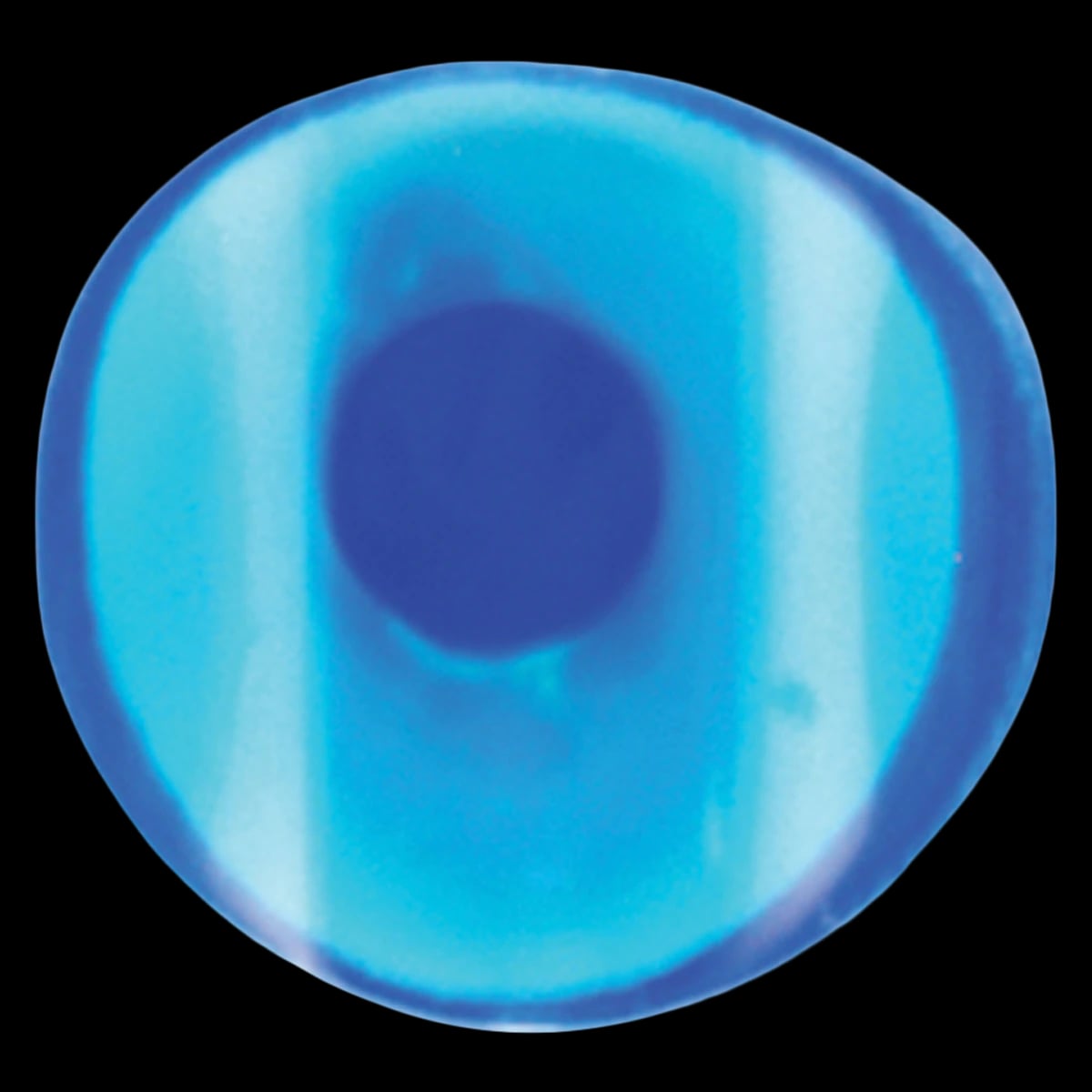 Garrison Blue View Cervical Matrices Refill, Size 1, 100/Pk, KCMA10