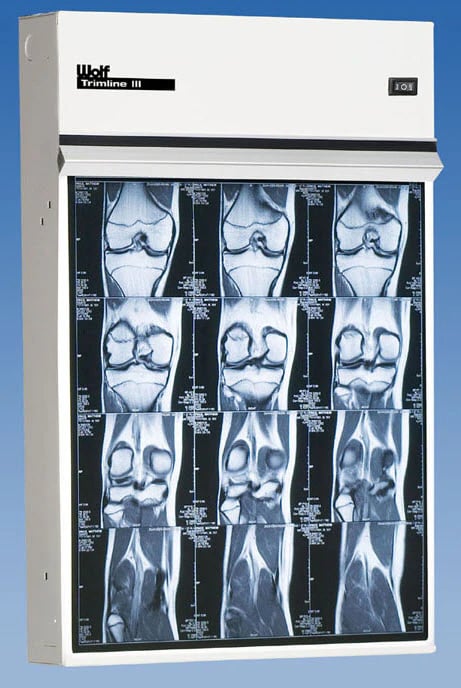 Wolf X-Ray Illuminator 3 Bank