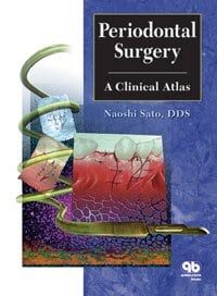 Periodontal Surgery: A Clinical Atlas by Naoshi Sato, 448 pp, ISBN 9780867153774