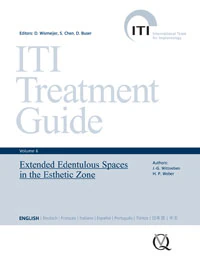 ITI Treatment Guide Volume 6: Extended Edentulous Spaces in the Esthetic Zone, 276 pp, ISBN 978-3-86867-141-4