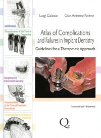 Atlas of Complications and Failures in Implant Dentistry: Guidelines for a Therapeutic Approach, 340 pp, ISBN 978-88-7492-182-9