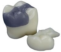 Model Onlay Patient Education Model, Plastic, 2.3 in x 1.8 in x 1.8 in, 2 Interchangeable Pieces