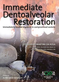 Immediate Dentoalveolar Restoration: Immediately Loaded Implants in Compromised Sockets (Book, 372 Pages) - Quintessence Publishing