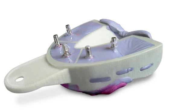Miratray Implant Advanced Impression Trays, Upper S2 Medium, 6/Pack, 101252