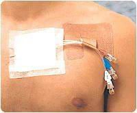 Cath-Strip Catheter Fastener with Cath Fastener, by Miltex-Integra